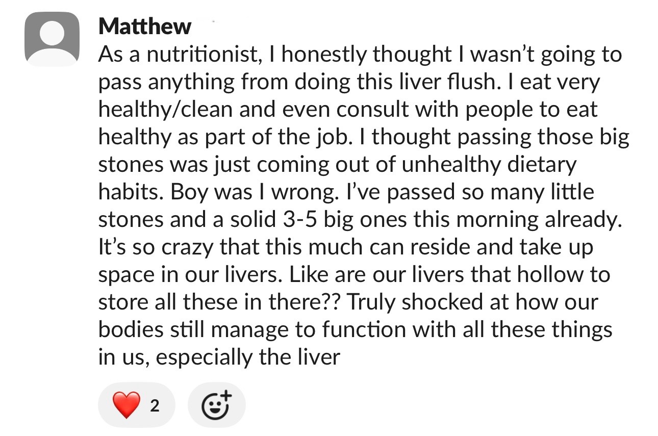 Matthew — passing stones after liver flushes