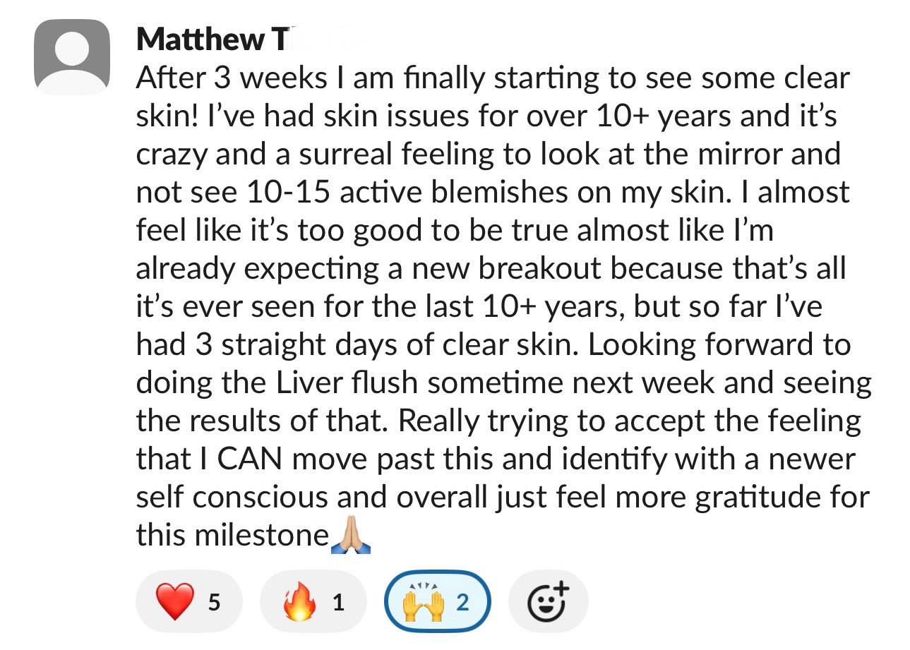 Matthew — 3 weeks of clear skin after 10+ years